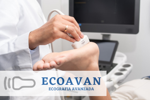 EcoAvan